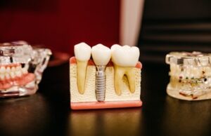 dr pranathi reddy oral surgeon