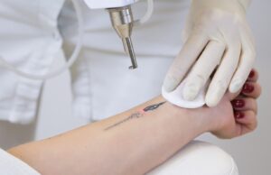 Dr. Jason Emer, MD, Reviews Tattoo Removal